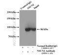 NSUN2 Antibody in Immunoprecipitation (IP)