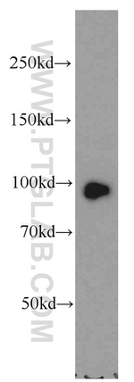 NSUN2 Antibody in Western Blot (WB)