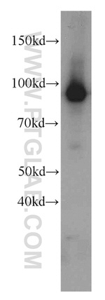 NSUN2 Antibody in Western Blot (WB)