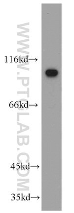 NSUN2 Antibody in Western Blot (WB)