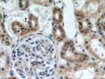 SLC38A4 Antibody in Immunohistochemistry (Paraffin) (IHC (P))