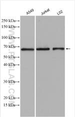 SLC38A4 Antibody in Western Blot (WB)