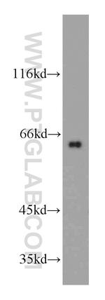 SLC38A4 Antibody in Western Blot (WB)