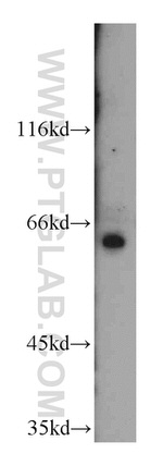 SLC38A4 Antibody in Western Blot (WB)