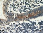 CCDC93 Antibody in Immunohistochemistry (Paraffin) (IHC (P))