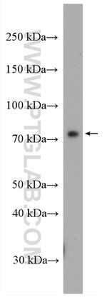 CCDC93 Antibody in Western Blot (WB)