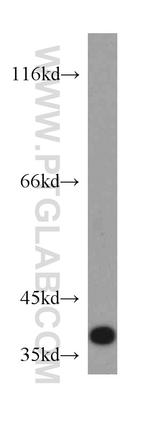 FAM76A Antibody in Western Blot (WB)