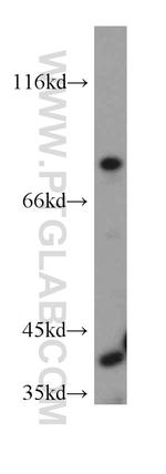 TFPI Antibody in Western Blot (WB)