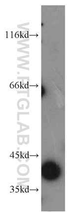 TFPI Antibody in Western Blot (WB)