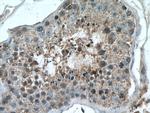 RHBDD1 Antibody in Immunohistochemistry (Paraffin) (IHC (P))