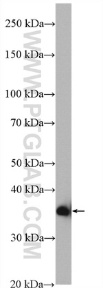 RHBDD1 Antibody in Western Blot (WB)