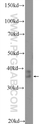 RHBDD1 Antibody in Western Blot (WB)