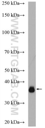 RHBDD1 Antibody in Western Blot (WB)