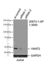 VMAT2 Antibody in Western Blot (WB)