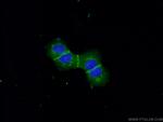 E-cadherin Antibody in Immunocytochemistry (ICC/IF)