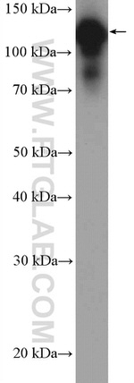 E-cadherin Antibody in Western Blot (WB)