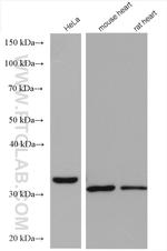 TTC19 Antibody in Western Blot (WB)