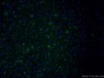 PKC epsilon Antibody in Immunohistochemistry (PFA fixed) (IHC (PFA))