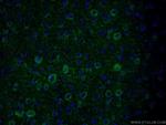 PKC epsilon Antibody in Immunohistochemistry (PFA fixed) (IHC (PFA))