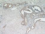 PKC epsilon Antibody in Immunohistochemistry (Paraffin) (IHC (P))