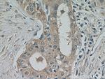 PKC epsilon Antibody in Immunohistochemistry (Paraffin) (IHC (P))