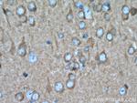 PKC epsilon Antibody in Immunohistochemistry (Paraffin) (IHC (P))