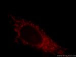 LZTS1 Antibody in Immunocytochemistry (ICC/IF)