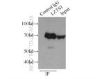 LZTS1 Antibody in Immunoprecipitation (IP)