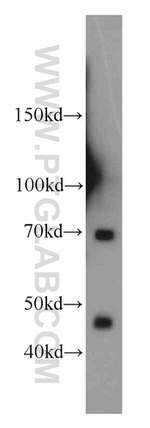 LZTS1 Antibody in Western Blot (WB)