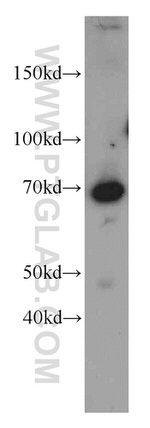 LZTS1 Antibody in Western Blot (WB)