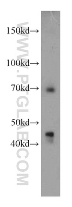 LZTS1 Antibody in Western Blot (WB)