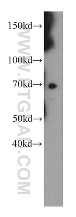 LZTS1 Antibody in Western Blot (WB)