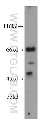 LZTS1 Antibody in Western Blot (WB)