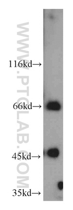 LZTS1 Antibody in Western Blot (WB)