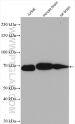 LZTS1 Antibody in Western Blot (WB)