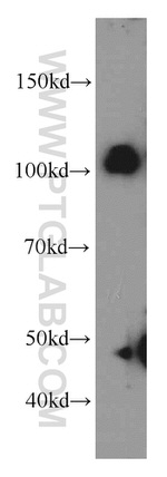 CUL4B Antibody in Western Blot (WB)