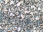 CUL4B Antibody in Immunohistochemistry (Paraffin) (IHC (P))