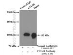 CUL4B Antibody in Immunoprecipitation (IP)