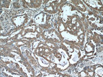 EPHB4 Antibody in Immunohistochemistry (Paraffin) (IHC (P))