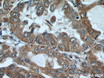 EPHB4 Antibody in Immunohistochemistry (Paraffin) (IHC (P))