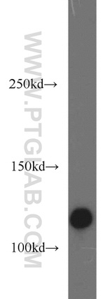 EPHB4 Antibody in Western Blot (WB)