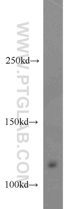 EPHB4 Antibody in Western Blot (WB)