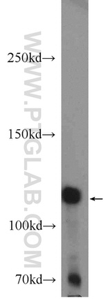 EPHB4 Antibody in Western Blot (WB)