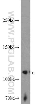 EPHB4 Antibody in Western Blot (WB)