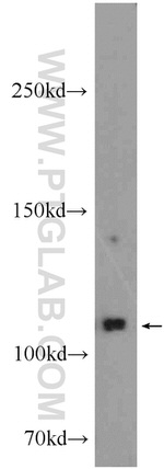 EPHB4 Antibody in Western Blot (WB)