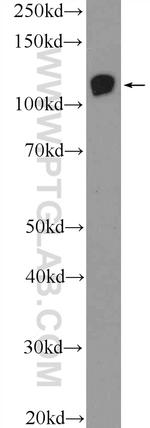 EPHB4 Antibody in Western Blot (WB)