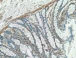 Caldesmon Antibody in Immunohistochemistry (Paraffin) (IHC (P))