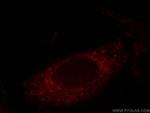 Caldesmon Antibody in Immunocytochemistry (ICC/IF)