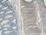 Caldesmon Antibody in Immunohistochemistry (Paraffin) (IHC (P))