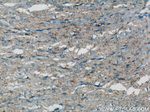 Caldesmon Antibody in Immunohistochemistry (Paraffin) (IHC (P))